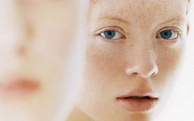 [ KIẾN THỨC ] NỖI BUỒN NÁM DA: PHÂN LOẠI, NGUYÊN NHÂN VÀ GIẢI PHÁP